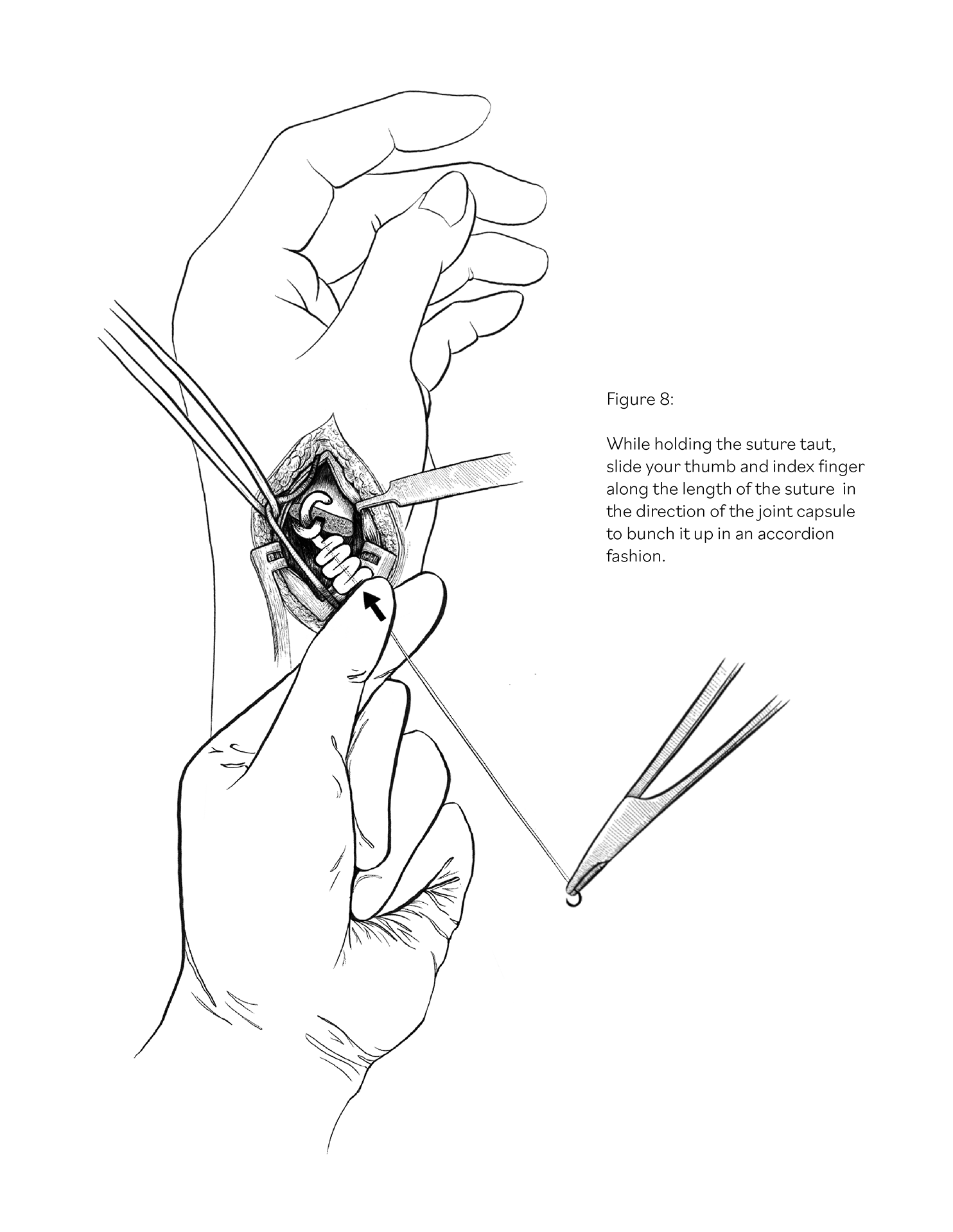 Surgical Illustration